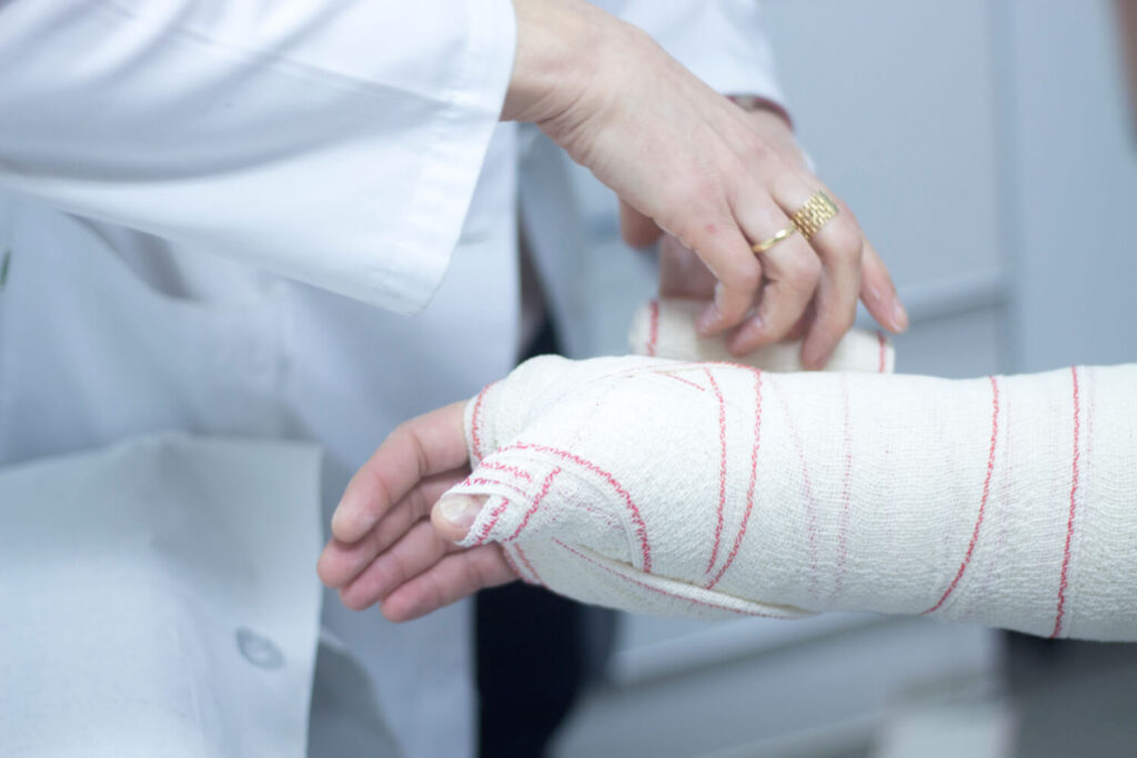 Questions to Ask a Personal Injury Lawyer After a Bicycle Accident in the Bay Area