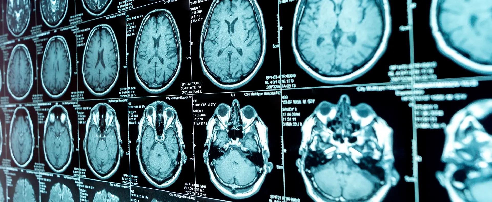 Medical professional operating a CT scanner for a patient representing a medical malpractice claim